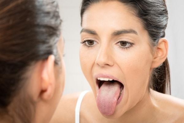 Ağzınız sinyal veriyor: Dilinizdeki bu renklere dikkat edin!  Kanser veya şeker hastalığının belirtisi olabilir